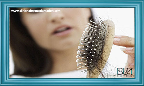 مهمترین علل ریزش مو در زنان