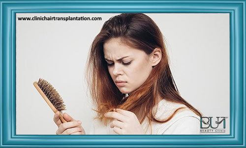 بیشترین علت ریزش مو در خانم ها