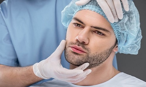 تحقیقات لازم قبل از عمل پیوند ریش