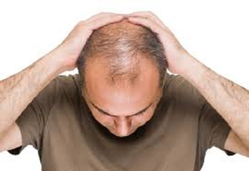 نحوه استفاده داروی فیناستراید برای درمان ریزش مو