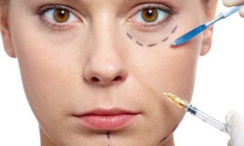 نقاط مورد تزریق برای فیلرهای پوستی _ کلینیک