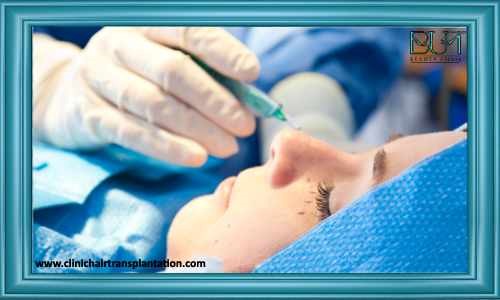 عمل جراحی بینی و رینوپلاستی