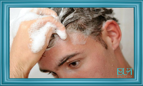 شستشوی مو قبل از کاشت مو