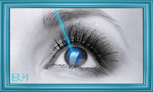 عمل لیزیک و لازک چشم چیست