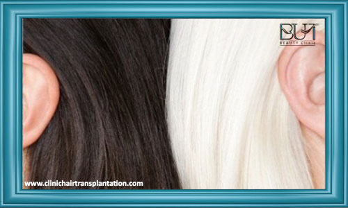 تفاوت انجام لیزر بر روی موهای سفید و معمولی